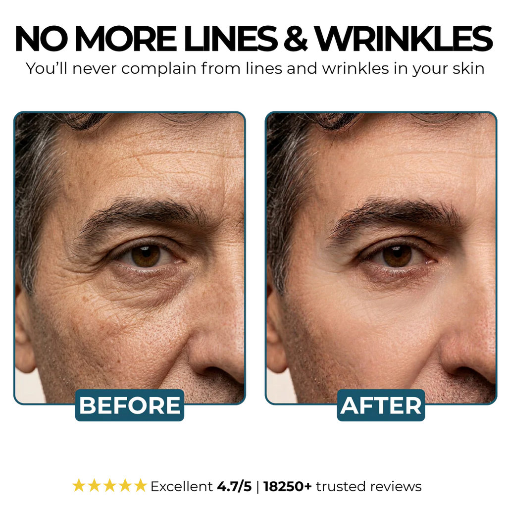 Anti-wrinkle Balm