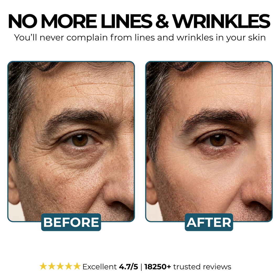 Anti-wrinkle Balm
